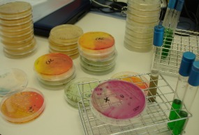 Fotografia cultivos en placas petri